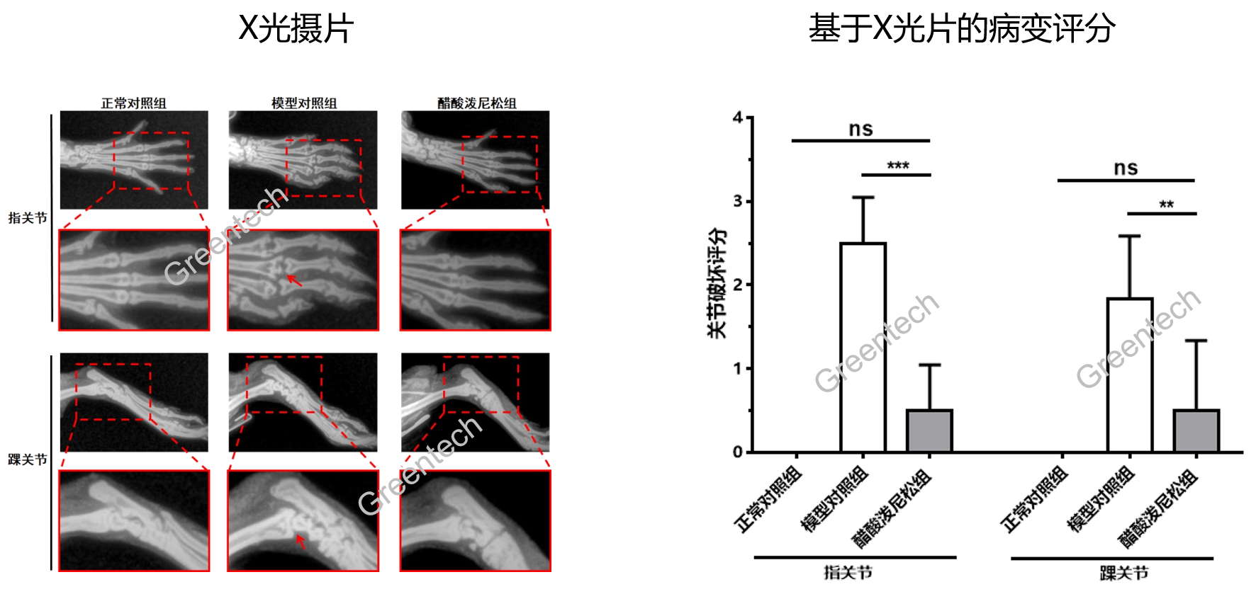 CIA模型足爪X光表现和关节破坏指数评分