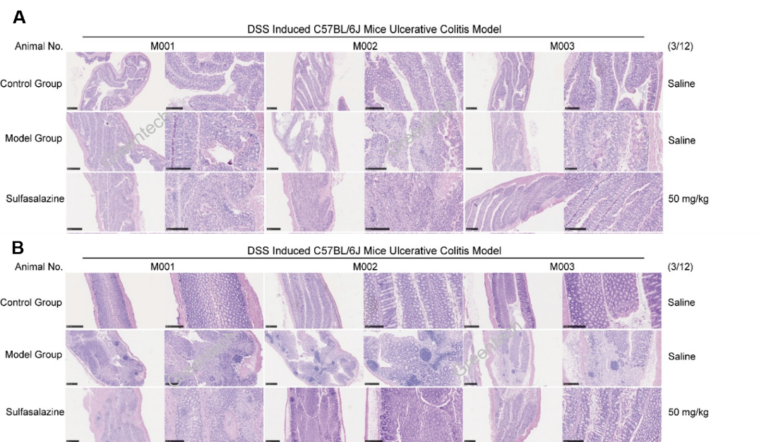 Colon section staining of DSS induced ulcerative colitis model in mice.png