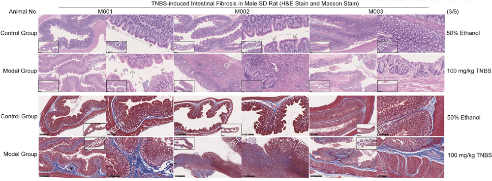 TNBS induced intestinal fibrosis in rats.png