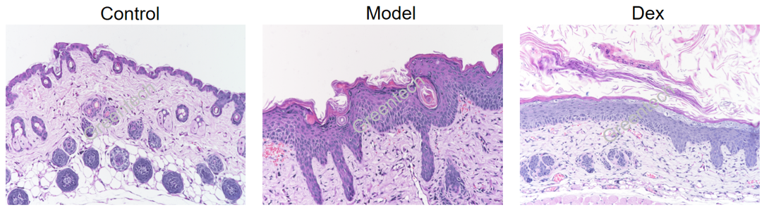 Histopathologic characteristics of IMQ-induced psoriasis mouse model.png