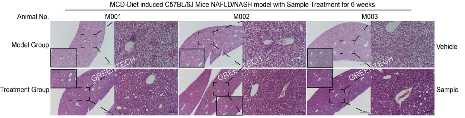 MCD饲料诱导NASH小鼠模型的肝脏组织病理学特征