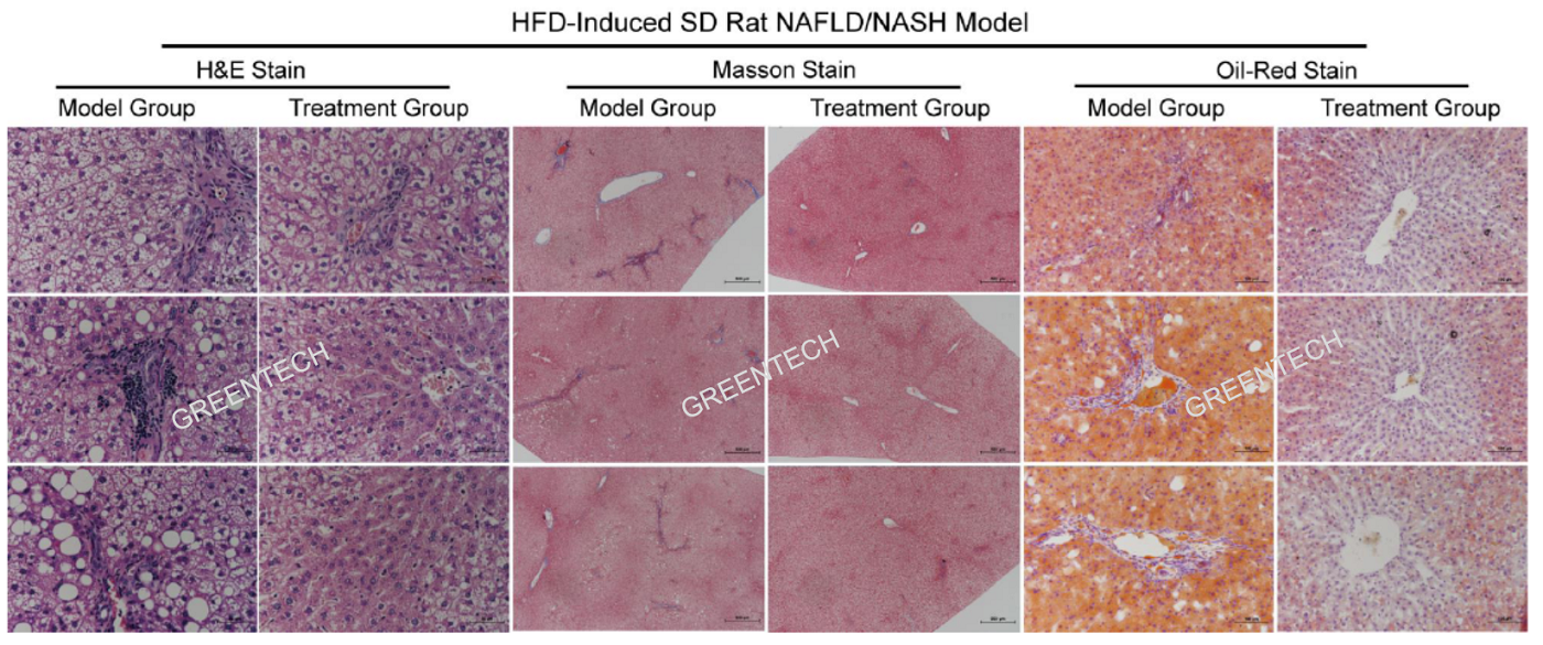 HFD饲料诱导12周后NASH动物模型的肝脏组织病理学