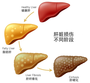 肝损伤阶段