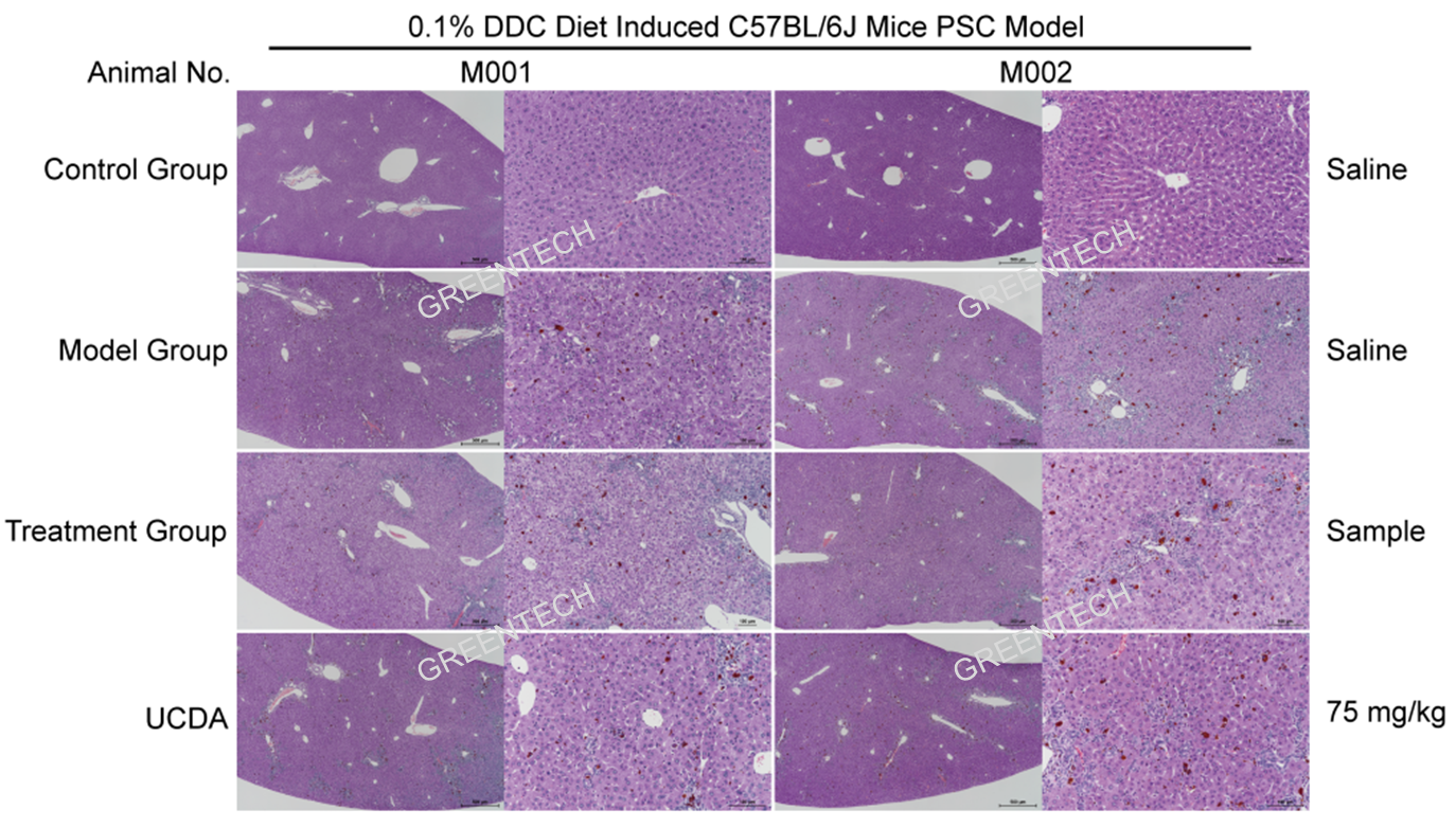 c57小鼠0.1% DDC饮食介入8周后肝脏组织病理学（HE染色）