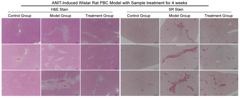 肝毒剂ANIT诱导SD大鼠4周后肝脏组织病理学（HE、SR染色）