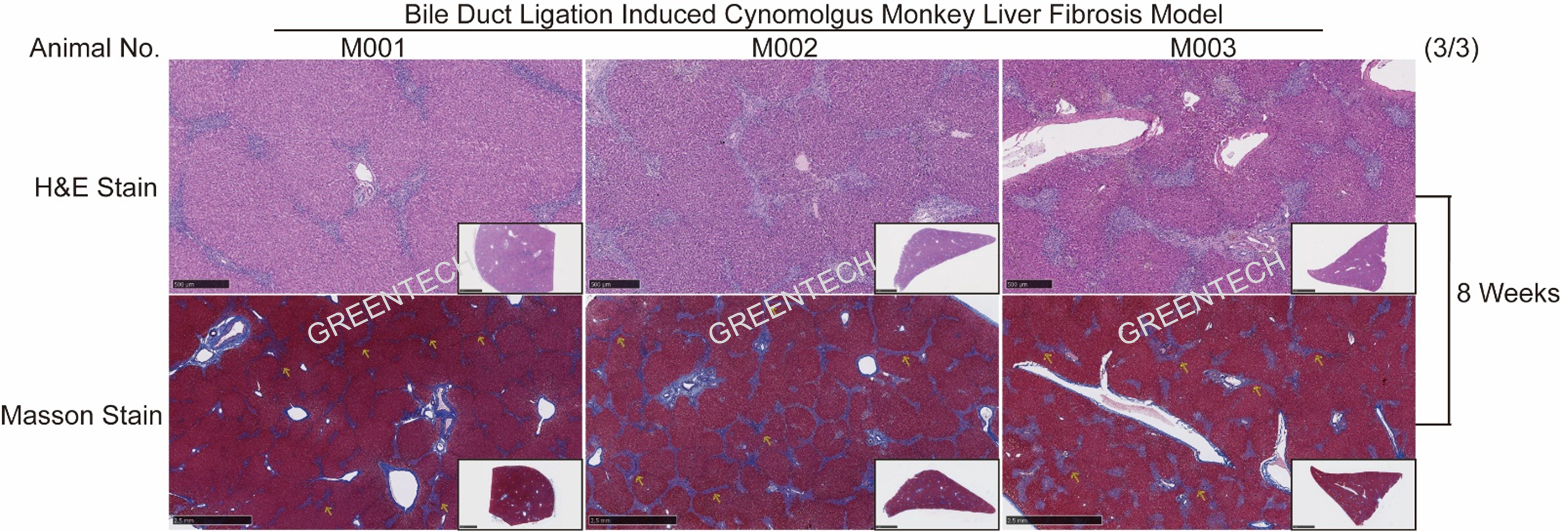 食蟹猴胆总管结扎8周后肝脏H&E染色及Masson染色